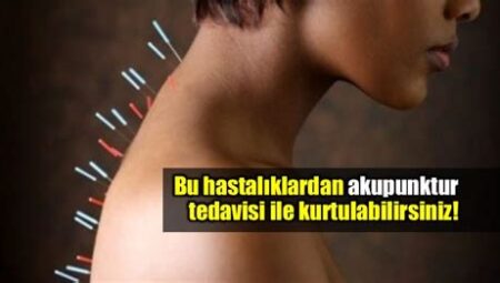 Akupunktur Tedavisi Hangi Alanlarda Kullanılır?