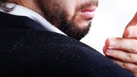 Yüzde Pullanmayı Önlemenin Doğal Yolları